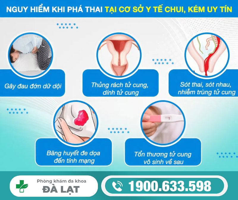 Hình ảnh minh họa
